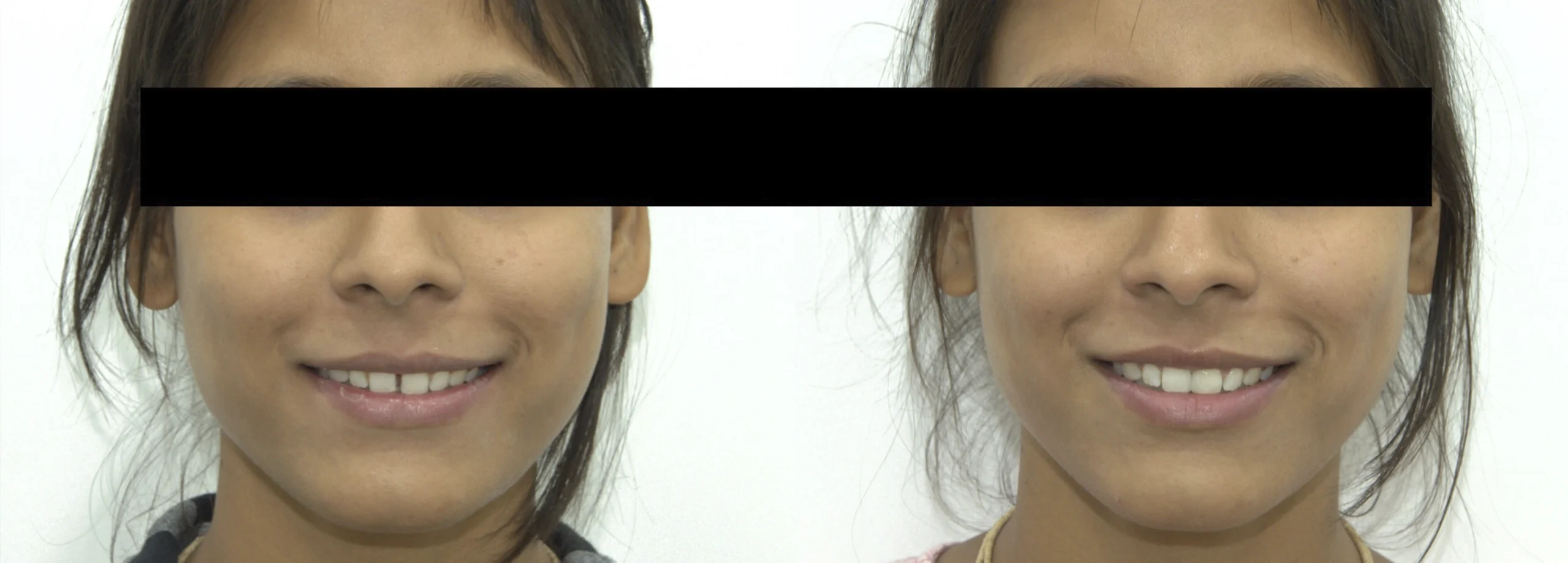 before after 10
