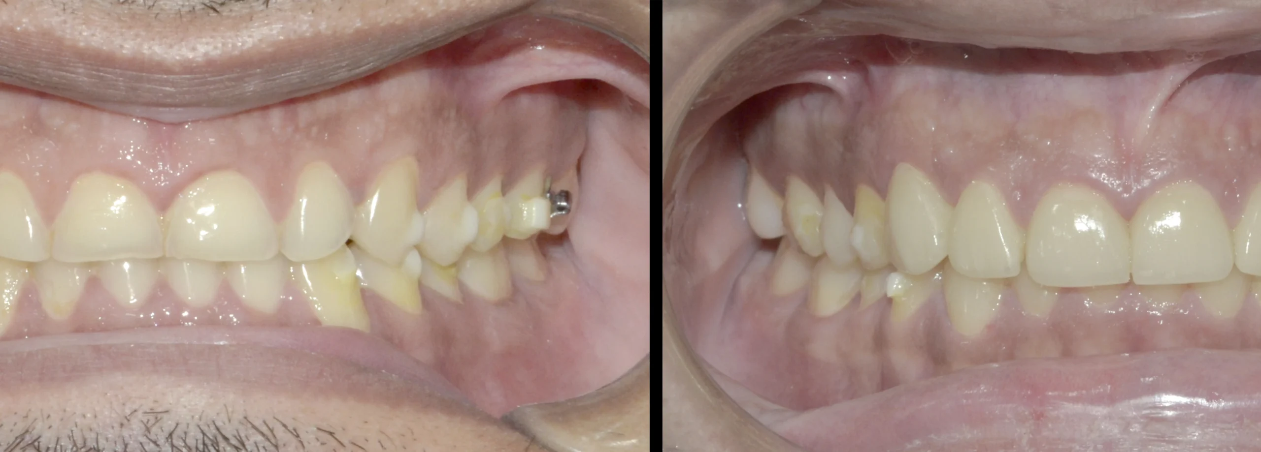 before after 12