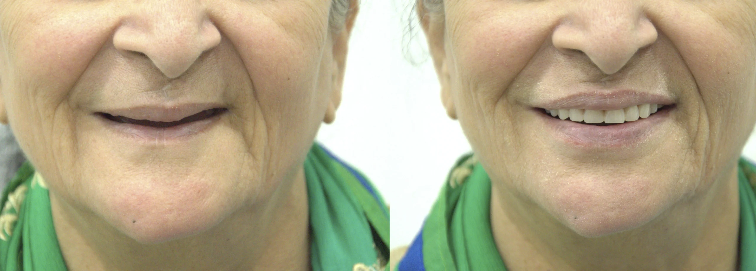 before after 3