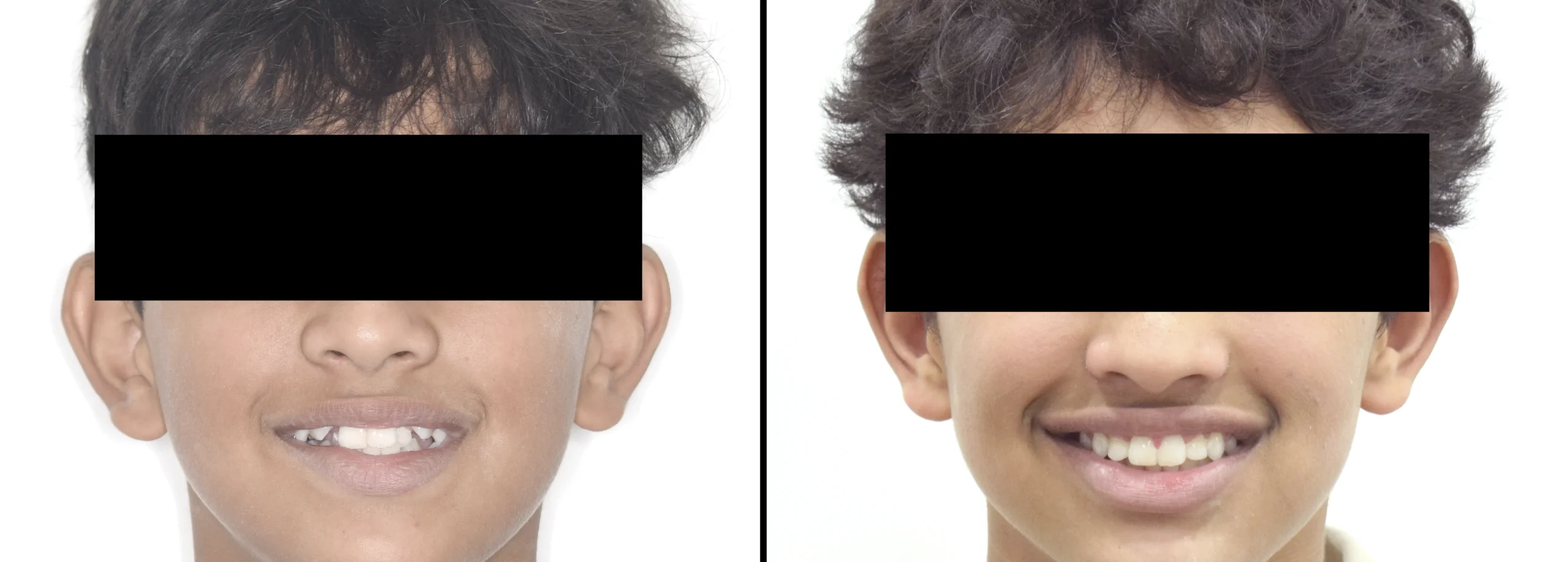 before after 6
