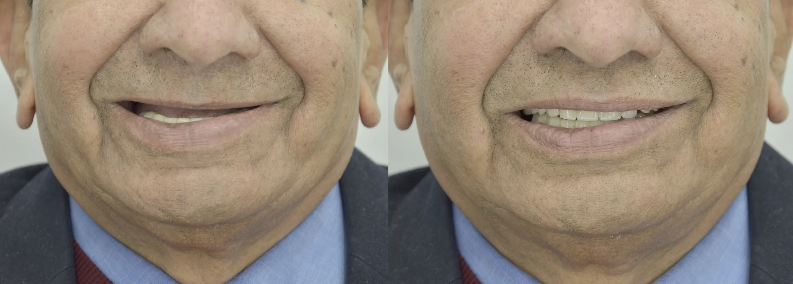 before after 7