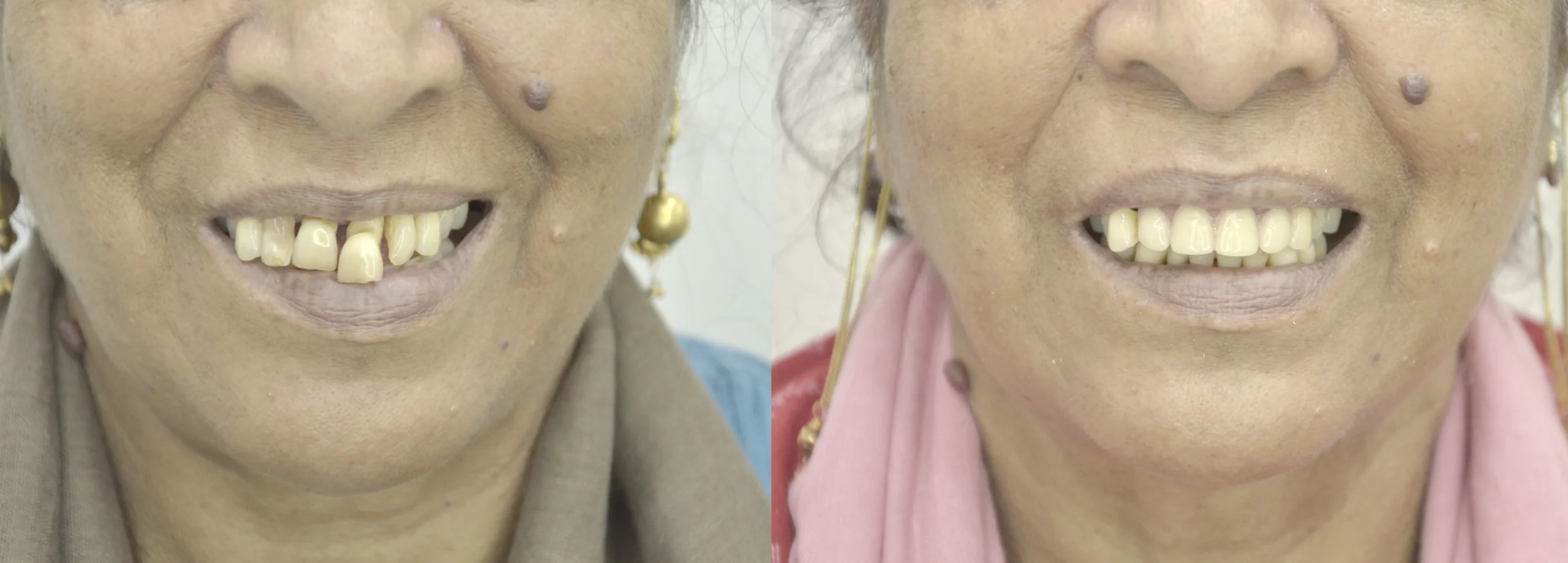 before after 8