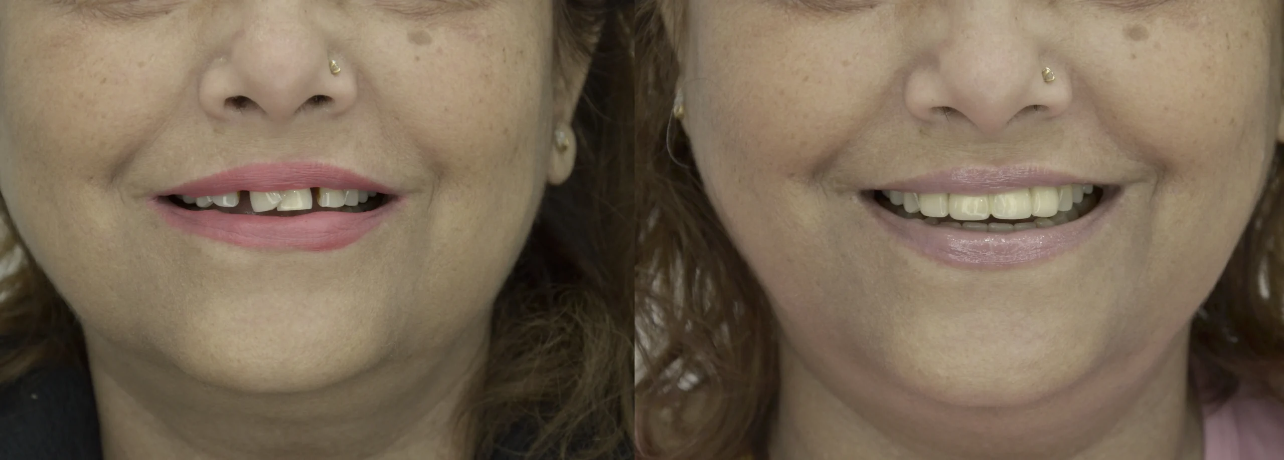 before after 9